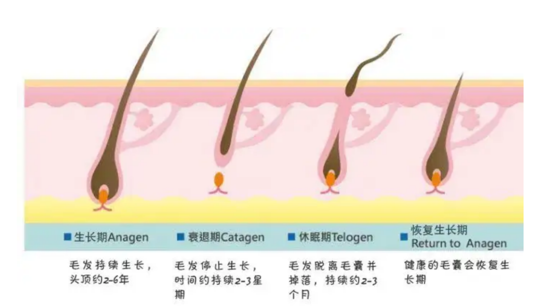 脱发机理