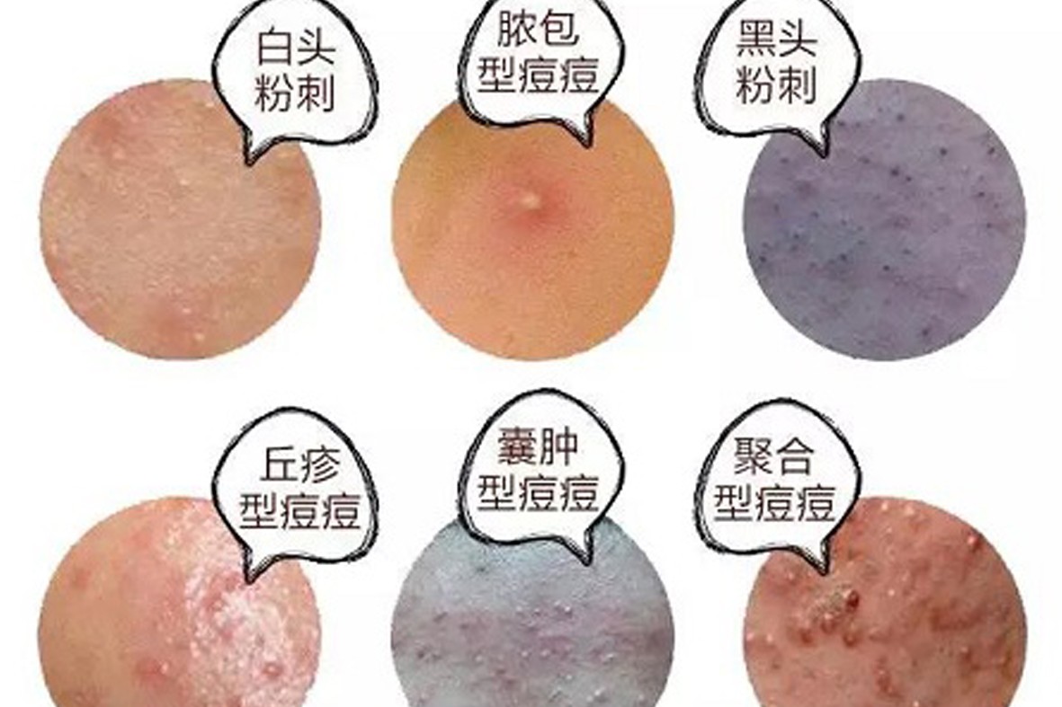 平痘复合剂0.jpg